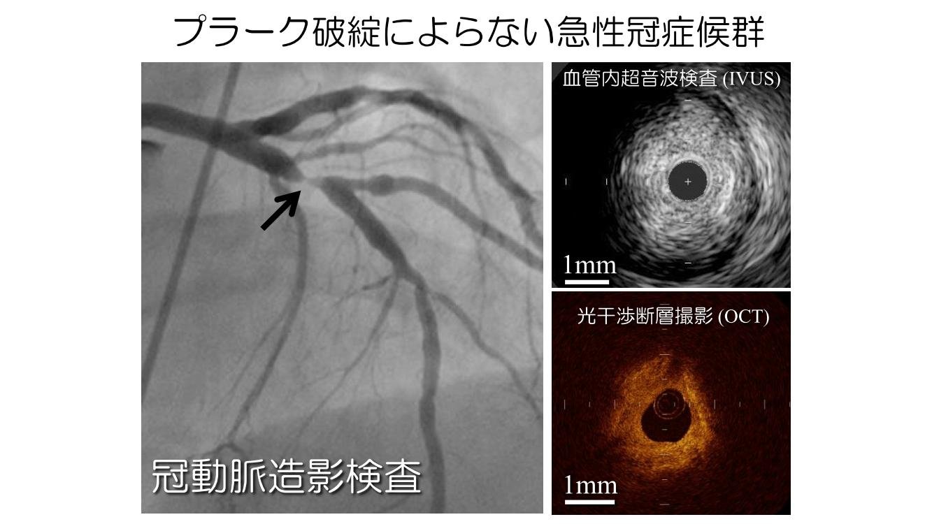 cardiovascular-medicine_HP11.jpg