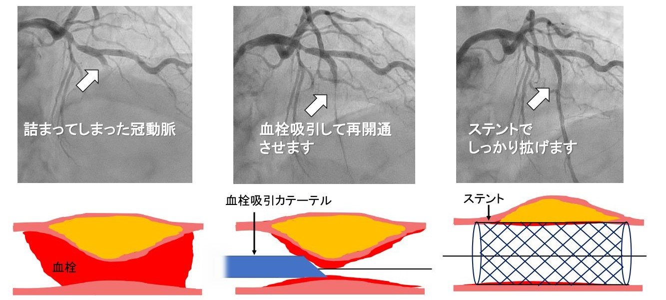 cardiovascular-medicine_HP14_2.jpg