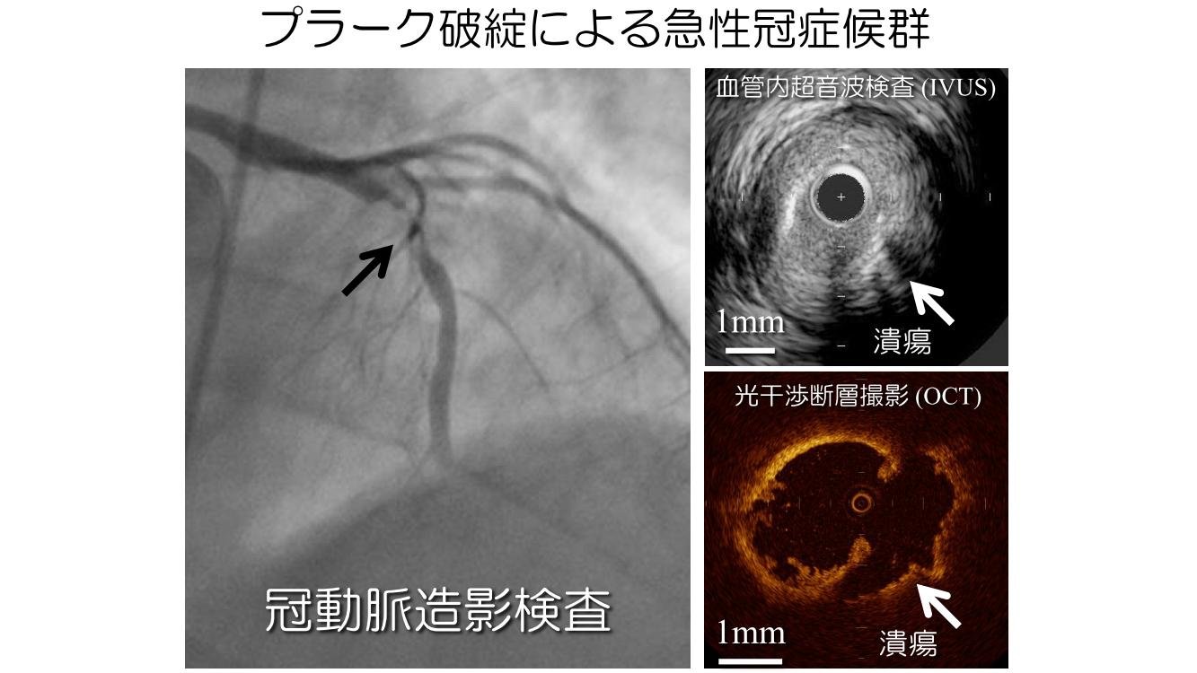cardiovascular-medicine_HP9.jpg