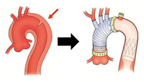 cardiovascular-surgery-136_1.jpg