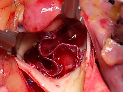 cardiovascular-surgery-140_3.jpg