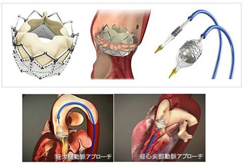 cardiovascular-surgery-140_4.jpg