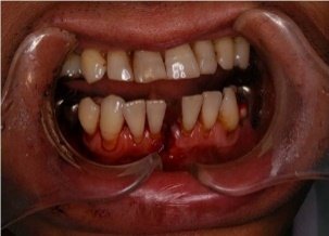 dental_cases_3.jpg