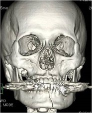 dental_cases_3.jpg