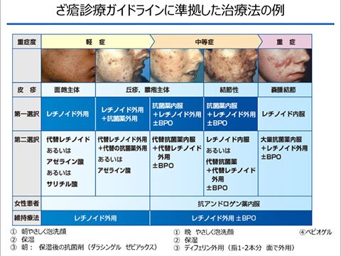 スドクレムとは何ですか?