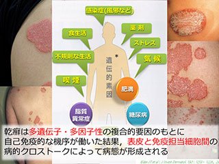 9. 滑り止めマットとグラブバーを設置する