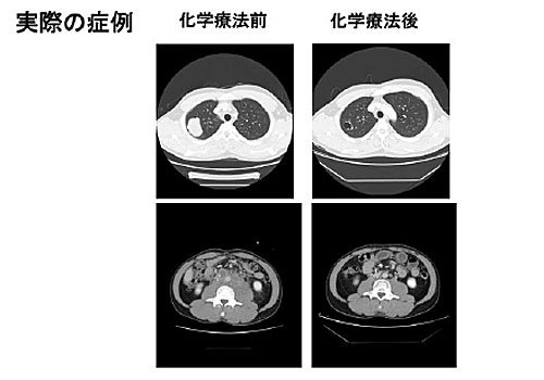 実際の症例